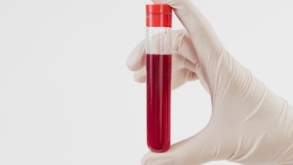 Comissão do Senado aprova meia-entrada para doadores de sangue